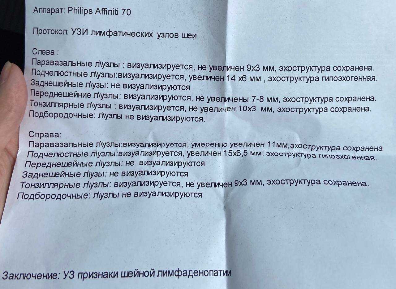 Славянам тютчев анализ кратко